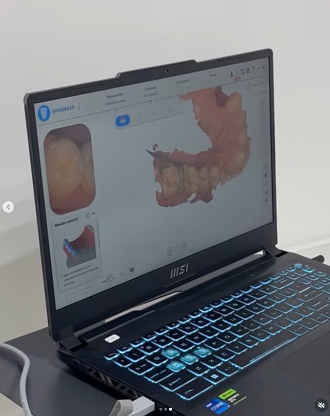 Scanner intraoral digital