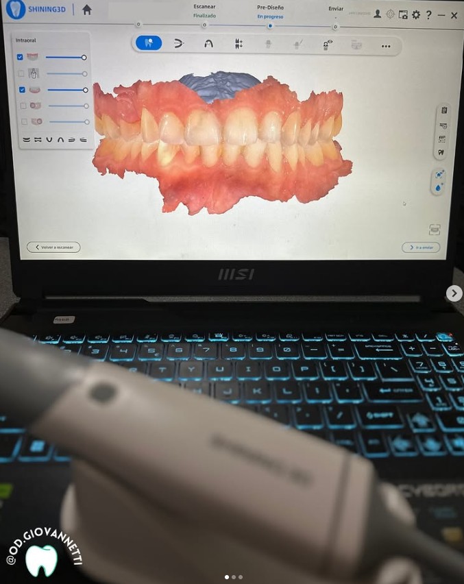 Modelo digital 3D odontológico